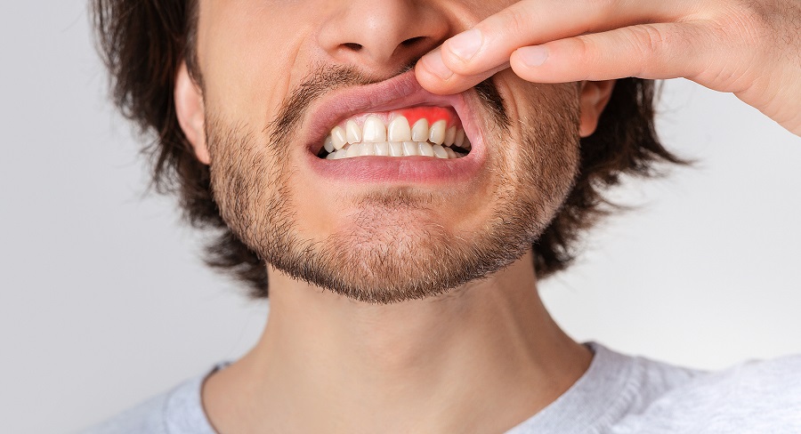 Factors Causing Gum Disease