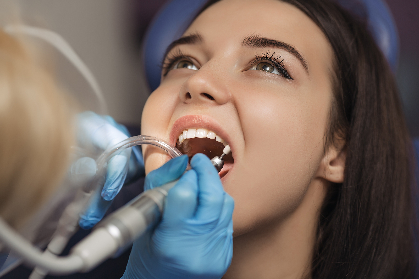 The Role of General Dentistry in Early Detection of Oral Health Issues